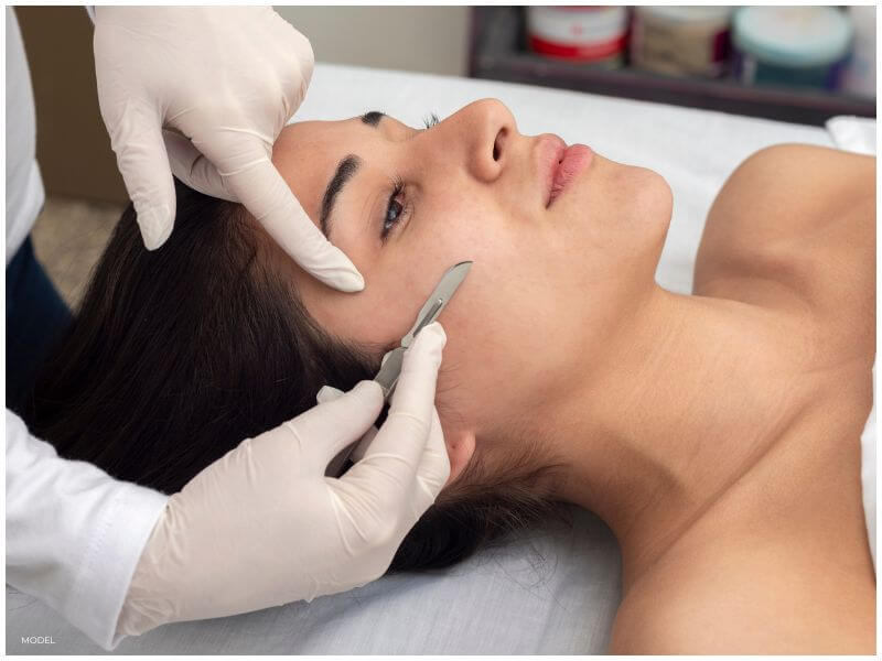 dermaplaning
