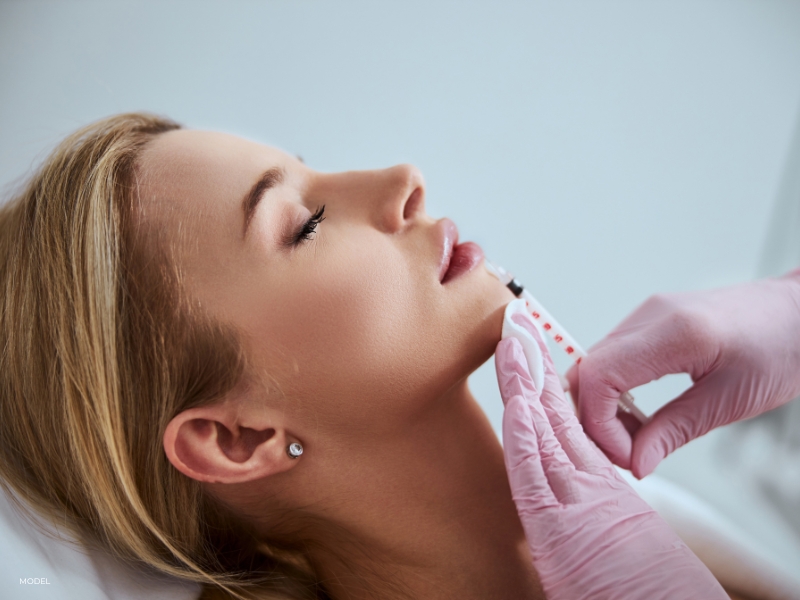 dermal fillers