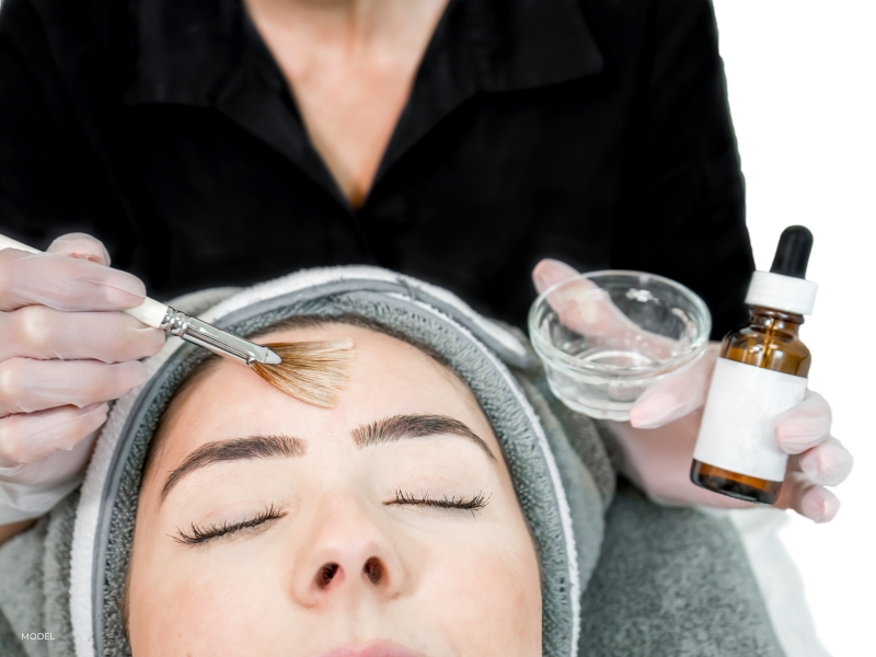 chemical peels