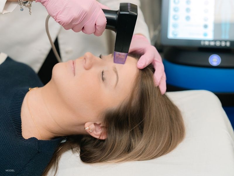 Microneedling