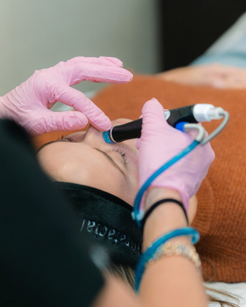 HydraFacial Treatments