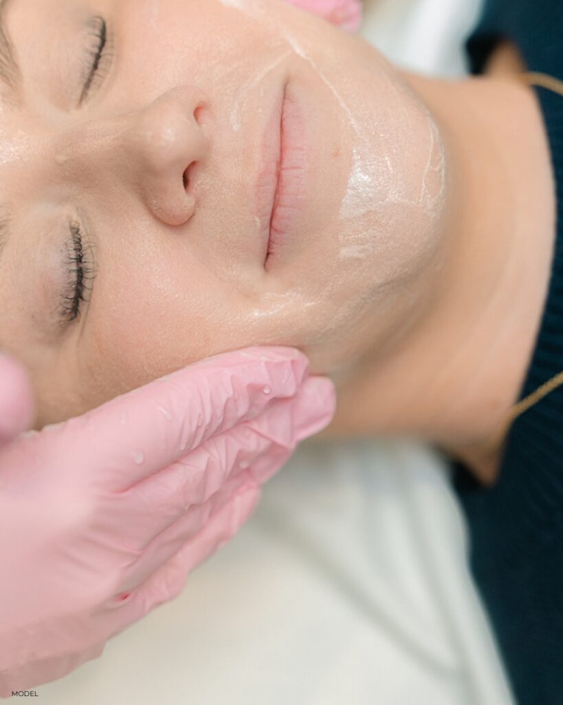 Medium Depth Peels